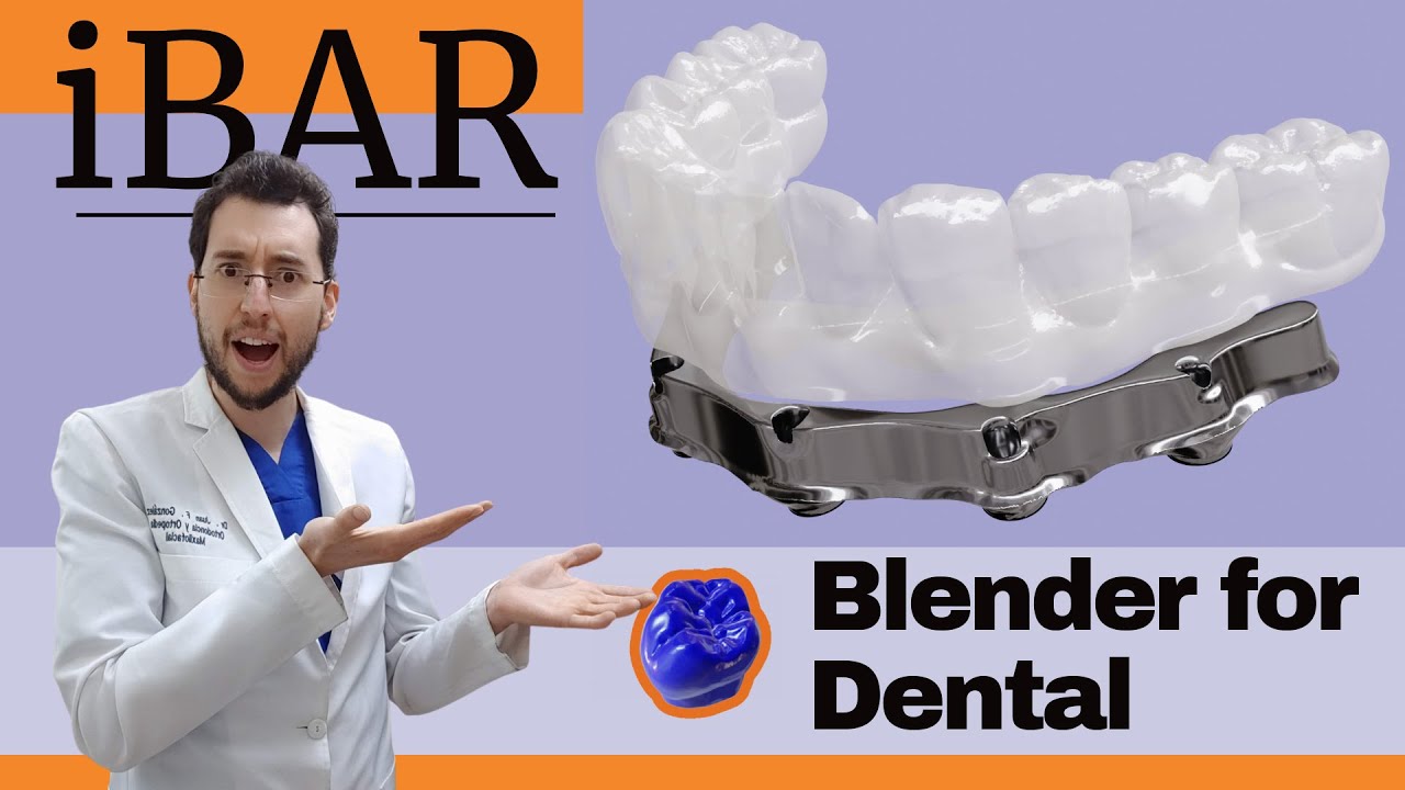💎BARRA para sobredentadura sobre IMPLANTES con Blender for Dental