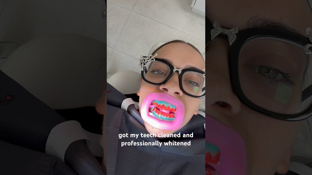honest teeth whitening review experience on sensitive teeth