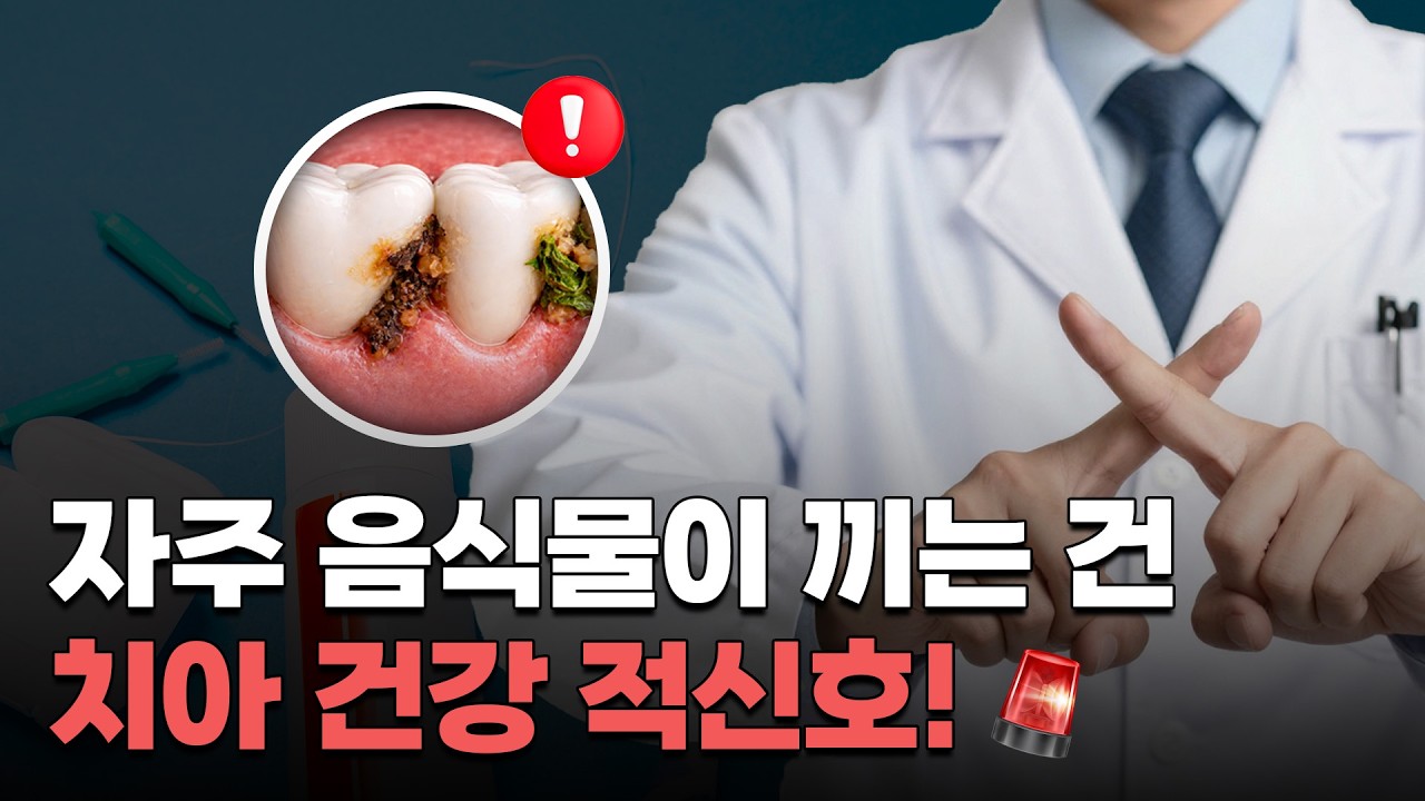 이에 자꾸 음식물 끼는 분들, 칫솔질만 열심히 하면 안 됩니다 ㅣ 치과의사가 알려주는 진짜 원인과 해결법