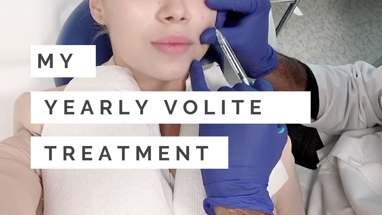 BEAUTY: GETTING MY YEARLY VOLITE TREATMENT