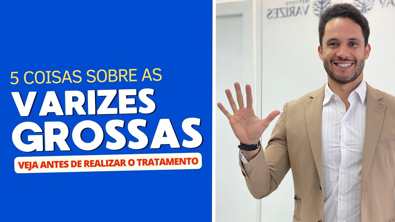 Varizes grossas: cinco coisas que voc&ecirc; precisa saber antes de fazer o tratamento   #varizes