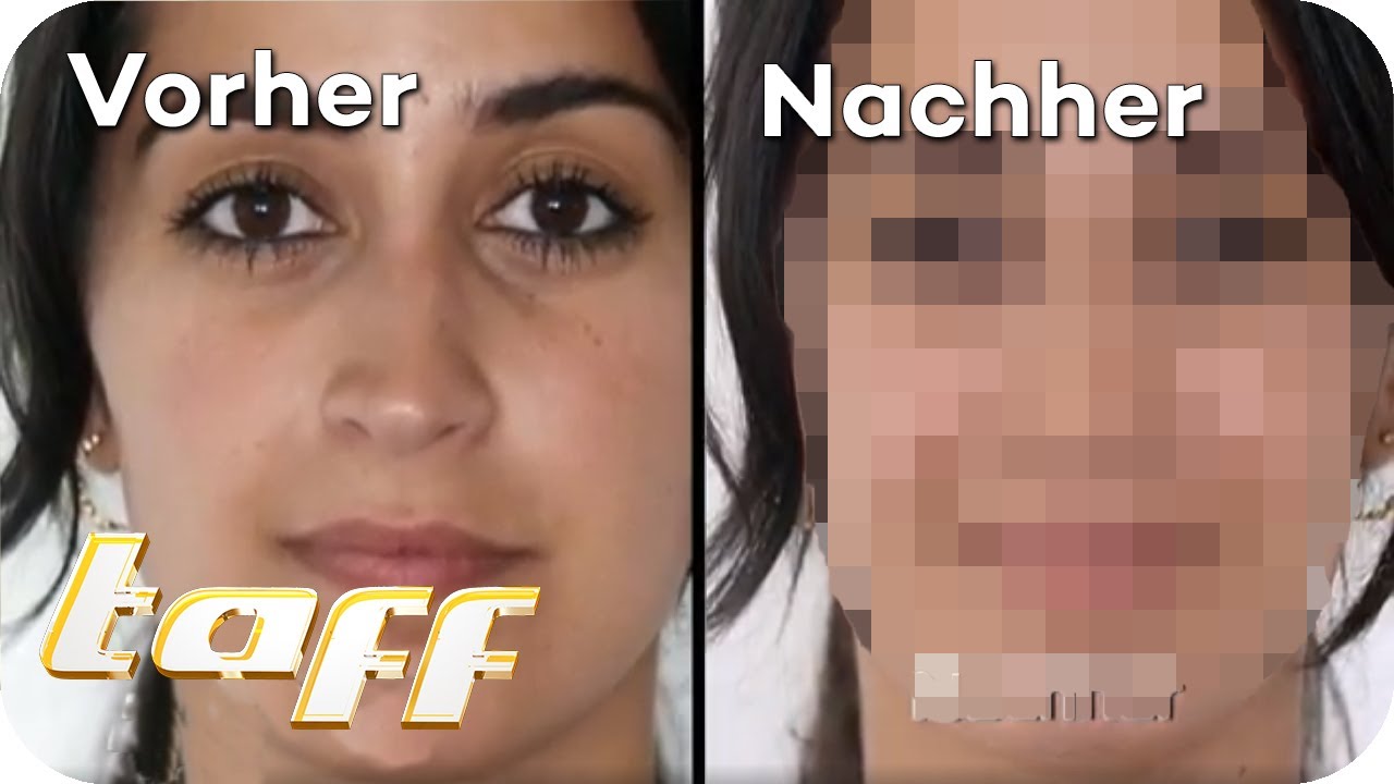 SKIN CARE: Schneckenschleim soll helfen! | taff | ProSieben