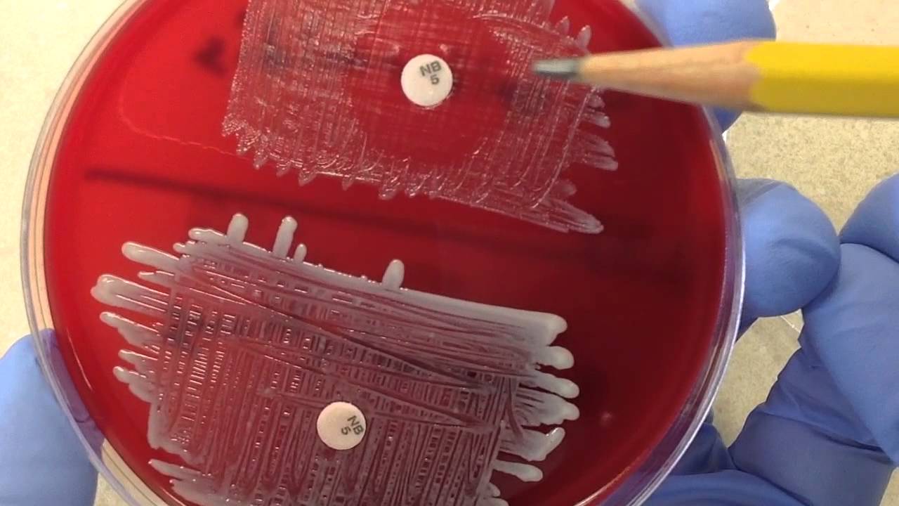 Microbiology - Novobiocin