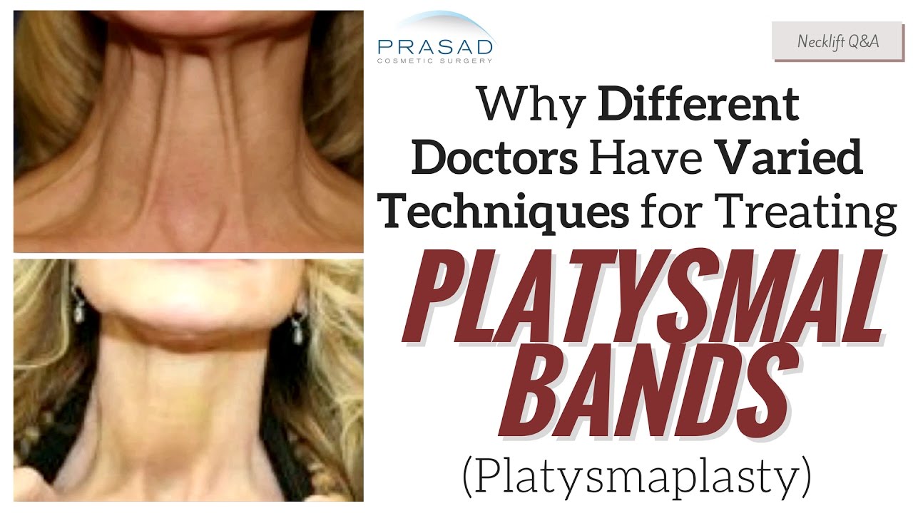 How Doctors May Change Necklift/Platysmaplasty Techniques to Best Suit Individuals