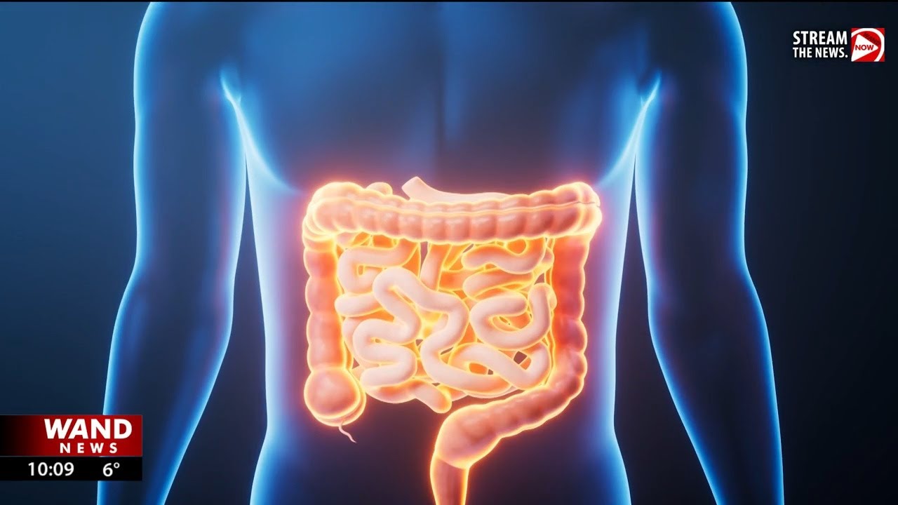Doctor urges early colon cancer screenings, even for younger adults