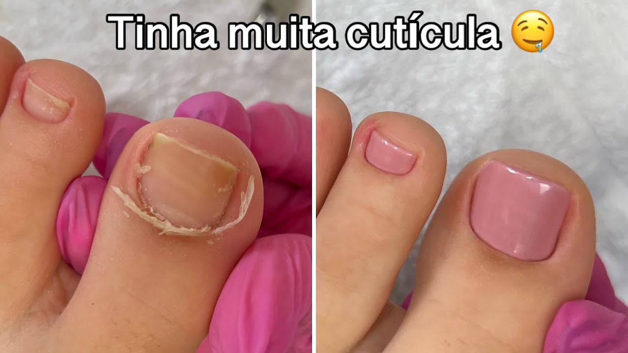 Transformação nas unhas dos pés | Cutícula e esmaltação