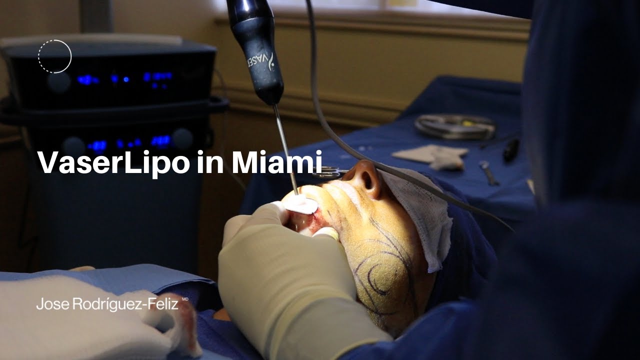 VaserLipo in Miami