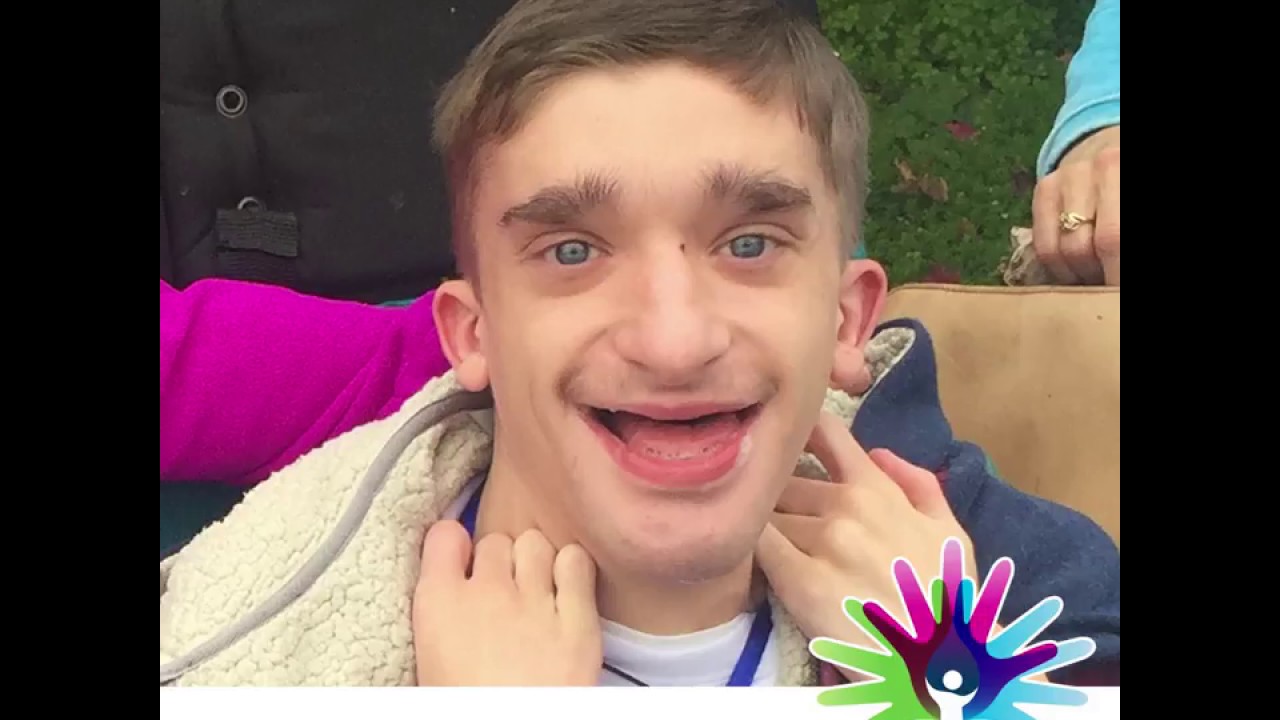 The Faces of Mowat-Wilson Syndrome - 2018