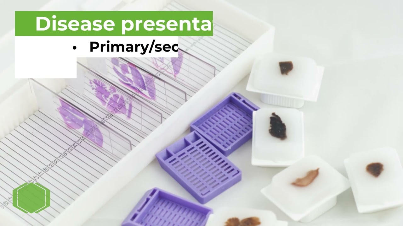 13,000+ human tissue samples from Central BioHub GmbH