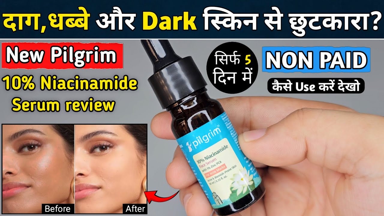 Pilgrim Niacinamide Serum | pilgrim niacinamide serum review | pilgrim face serum