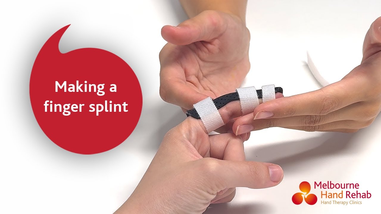 Making a finger splint