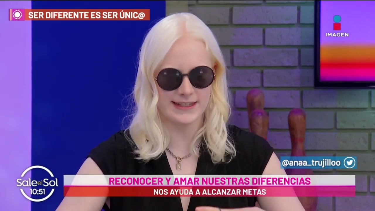 Ana Trujillo nos explica qué es el albinismo y por qué se produce l Tips de Vida l Sale El Sol