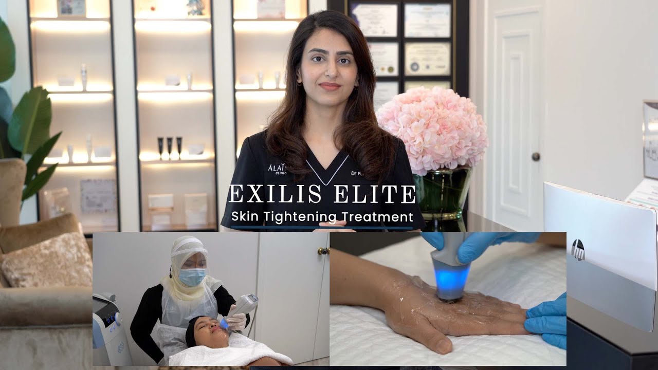 Exillis FAQs