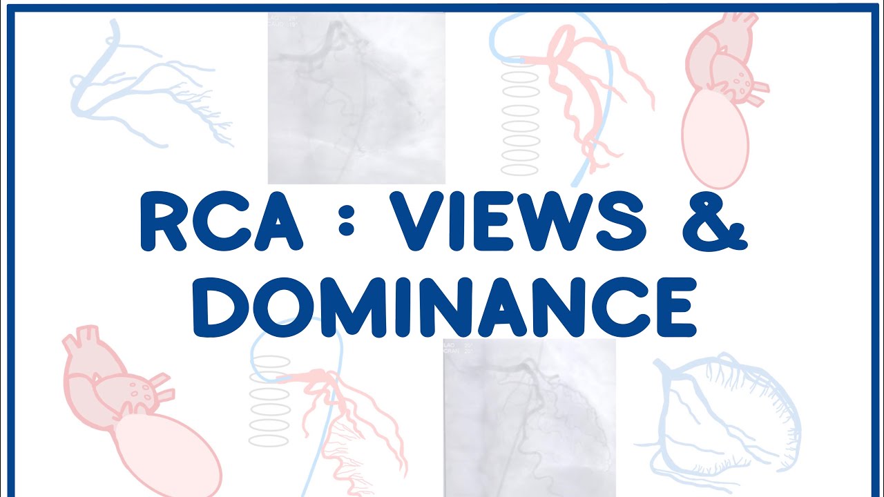 Right Coronary Artery Angiogram Views & Dominance