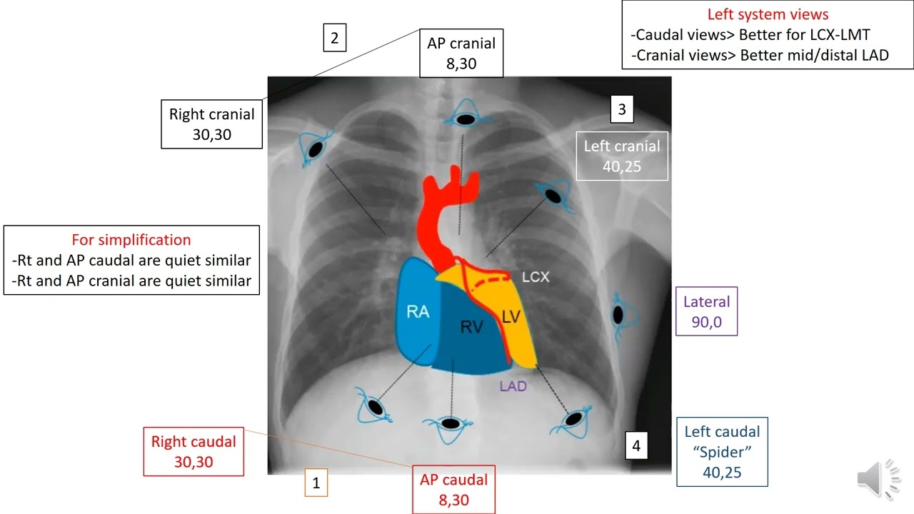 How to read coronary angiography
