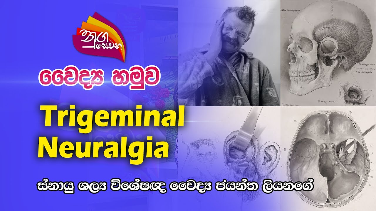 Nugasewana | වෛද්‍ය හමුව - Trigeminal neuralgia |2023-02-24|rupavahini