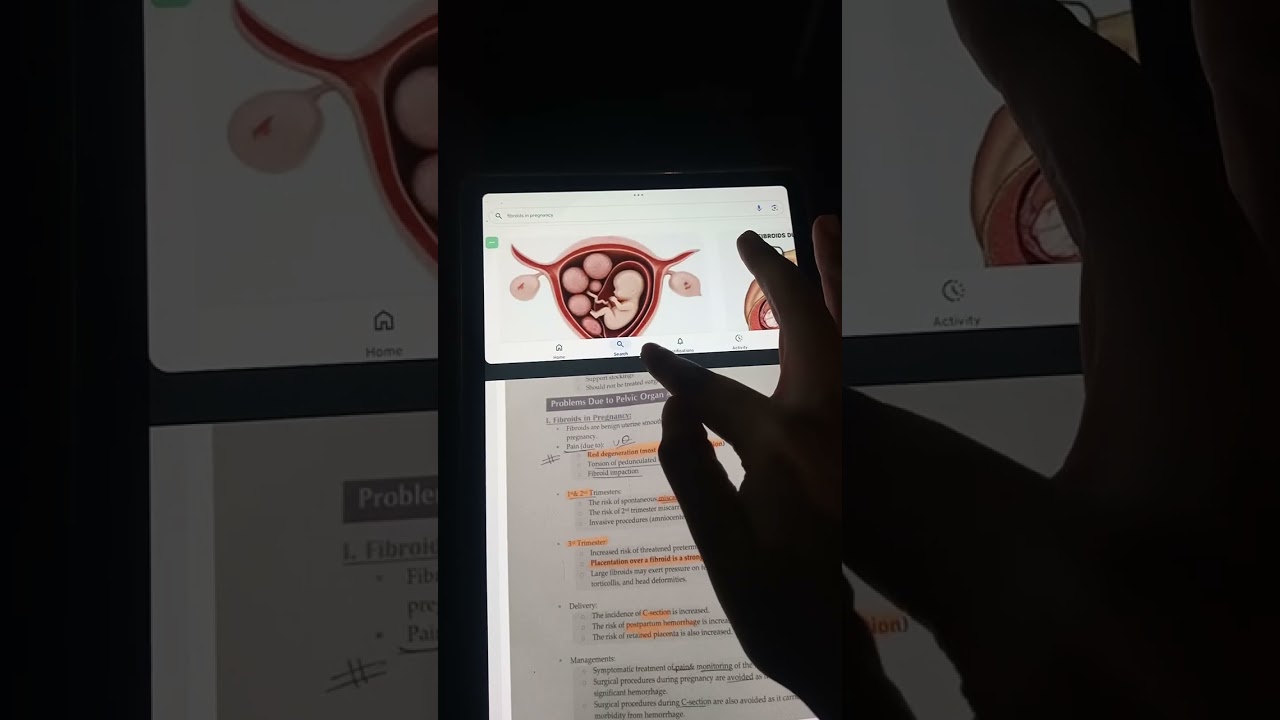 Ch 8 Antenatal obstetric complications,obstetrics, Irfan Masood quick review