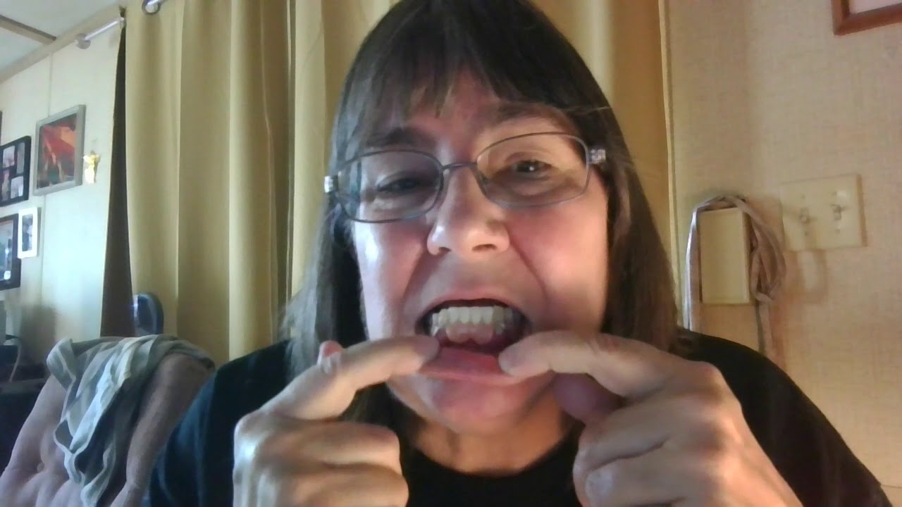 Putting dentures in