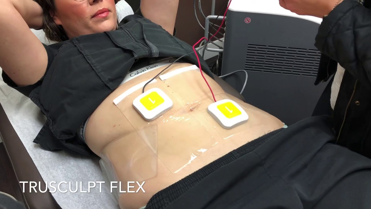 The latest innovation in muscle sculpting and toning called TruSculpt Flex at Laser Clinique
