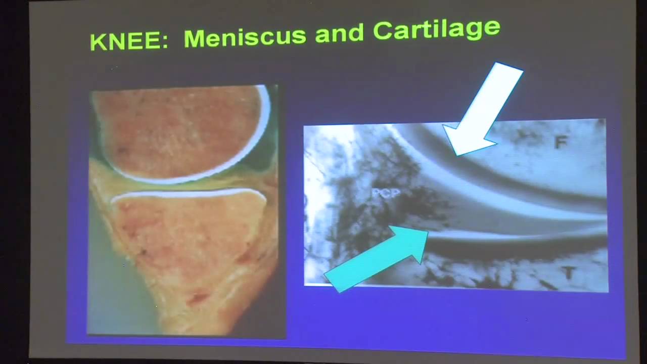 Joint Restoration - Dr. Wyland Part 1