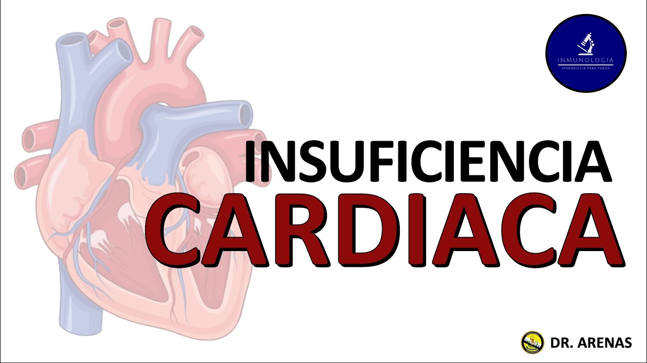 Insuficiencia Cardiaca: Definición, fisiopatología y diagnostico  (Explicado fácilmente)
