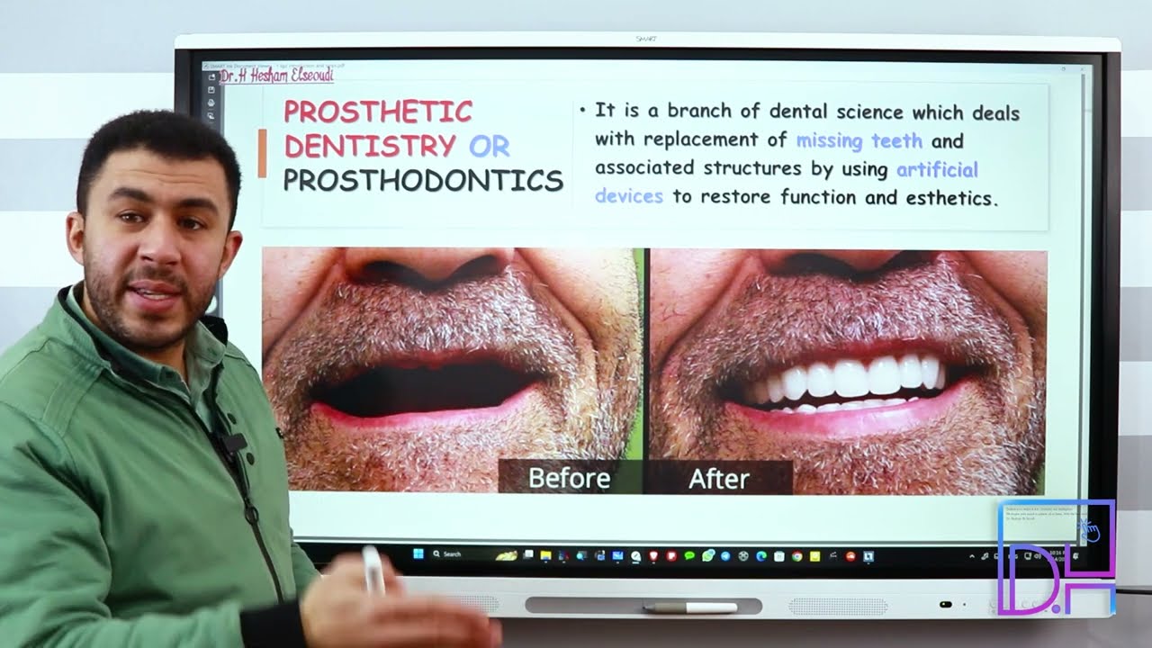 1- Introduction to Removable Partial Denture