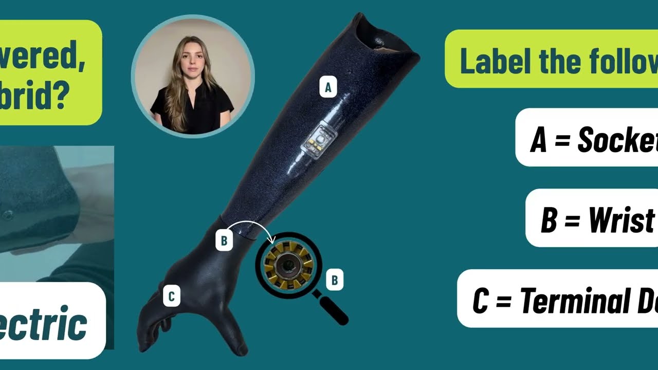 Components of an Upper Limb Prosthesis