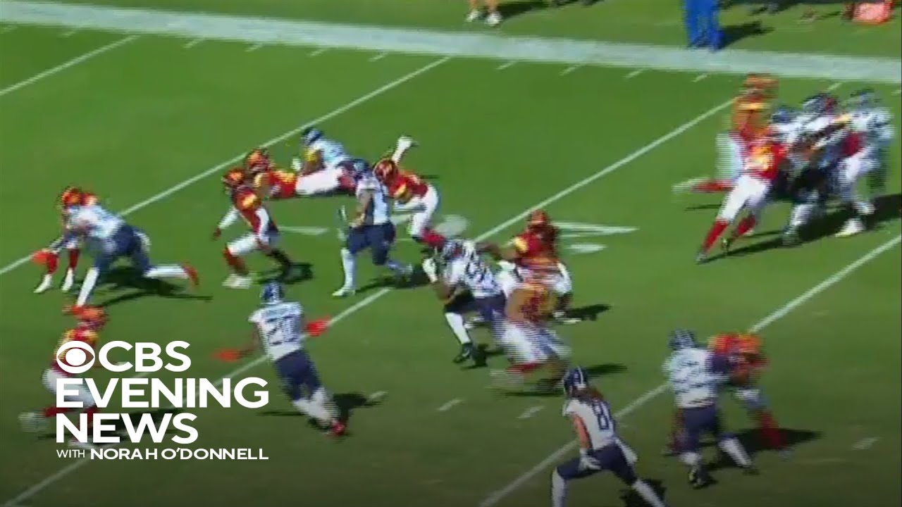NFL announces updated concussion protocol
