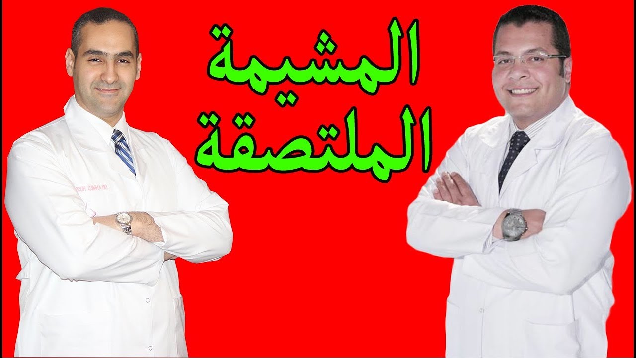 المشيمة الملتصقة - سببها و طريقة علاجها - د. احمد حسين