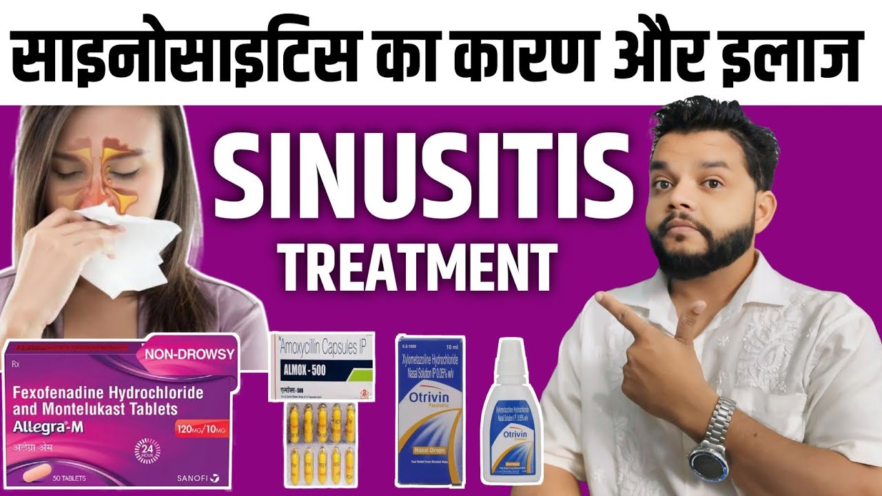 Sinusitis Causes, Symptoms, Diagnosis &  Allopathic Treatment In Hindi / Sinusitis Explain