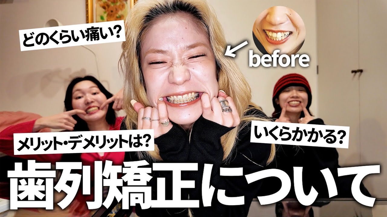 歯列矯正迷ってる人へ！リアルな費用や痛み、メリット・デメリット全部話します。