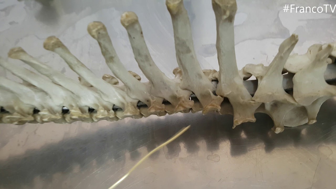 Anatomía - Columna vertebral, vertebra "tipo"