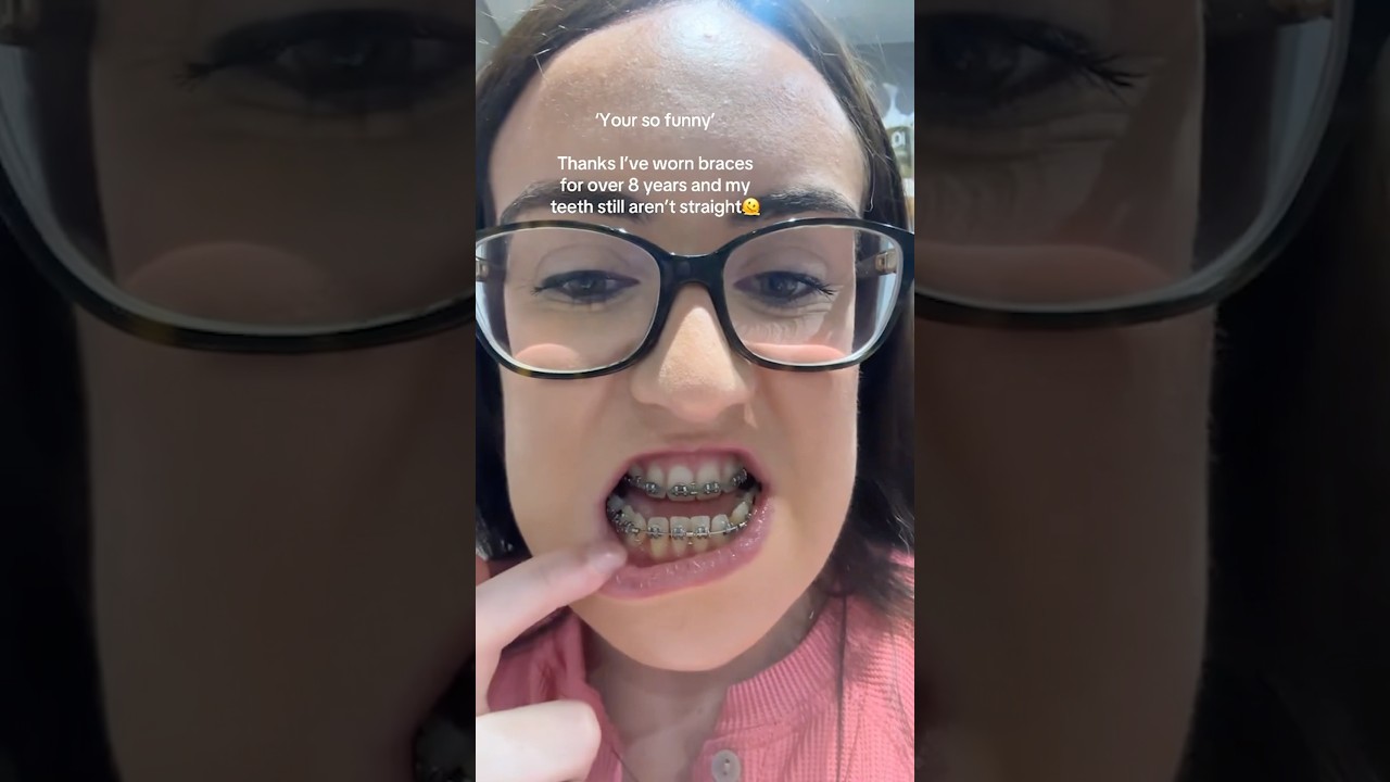 If Your Teeth Look Like THIS, You Might Need Jaw Surgery! 😳🦷