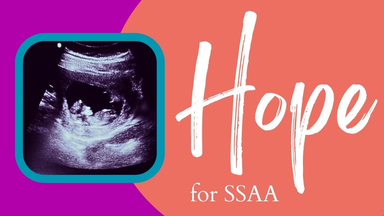 Hope (SSAA Choir) - by Zachary J. Moore