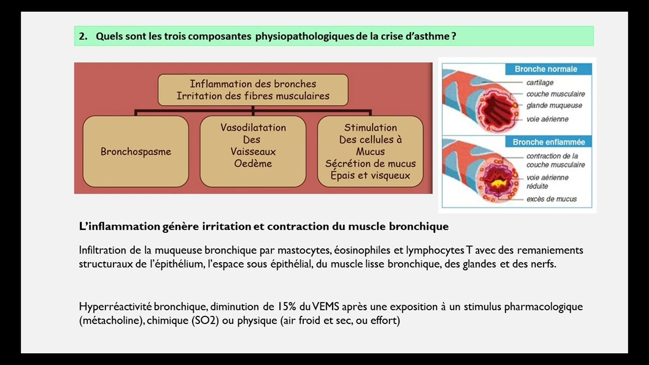 UE 2.8 Processus obstructifs- Asthme - questionnaire de révisions
