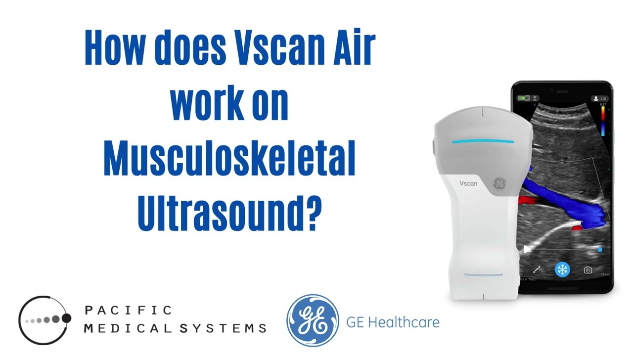 【How does Vscan Air work Musculoskeletal Ultrasound】 Wireless | Dual Probe | Handheld 💪🏼🦵🏼🦶🏼