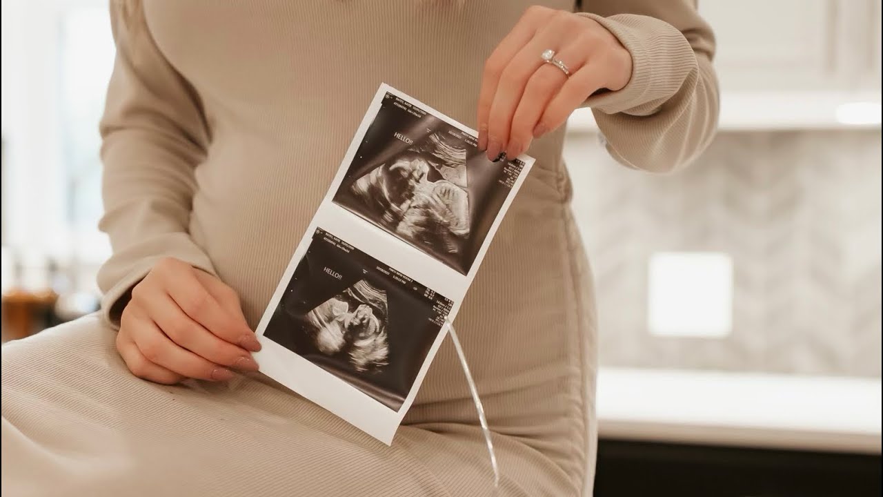 OUR 20 WEEK ANATOMY SCAN!
