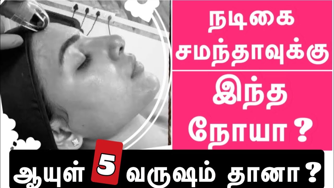 நடிகை சமந்தாவுக்கு என்ன நோய் தெரியுமா? | Actress Samantha suffered from ***disease | Doctor Pillai
