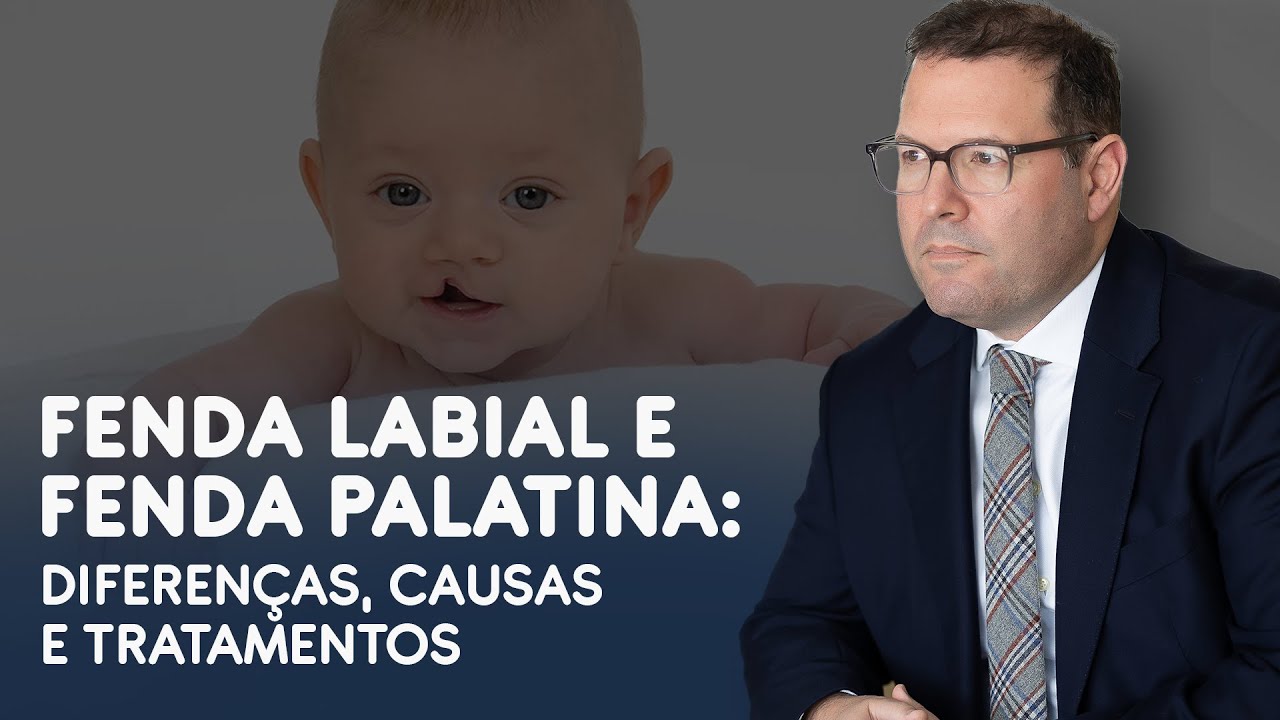 Fenda Labial e Fenda Palatina: Diferenças, Causas e Tratamentos