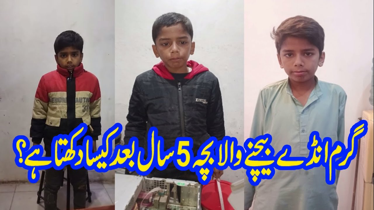 Hard worker child | Pakistan | Healthy Pakistani | Shuja Zaidi | Anday Walay | Garam Anday | today