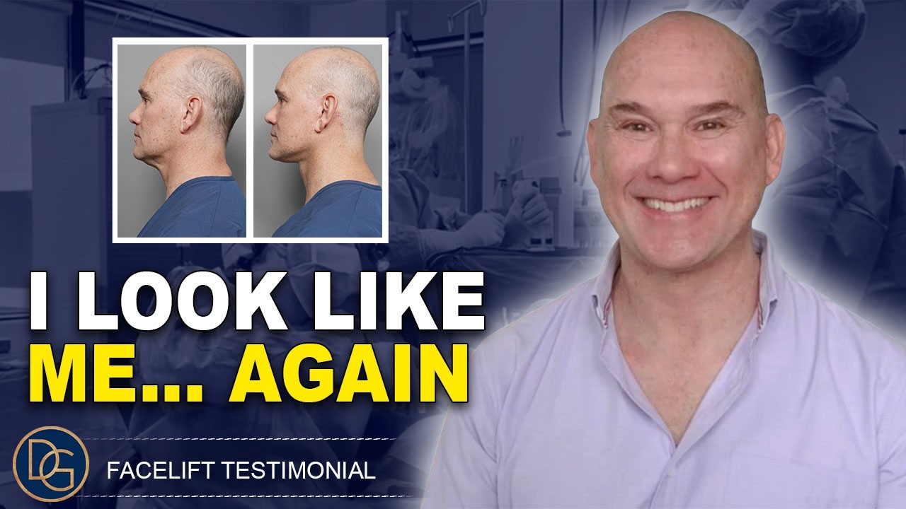 &ldquo;I look like me......again&rdquo; | Real Deep Plane Facelift & Eyelid Surgery Patient Review