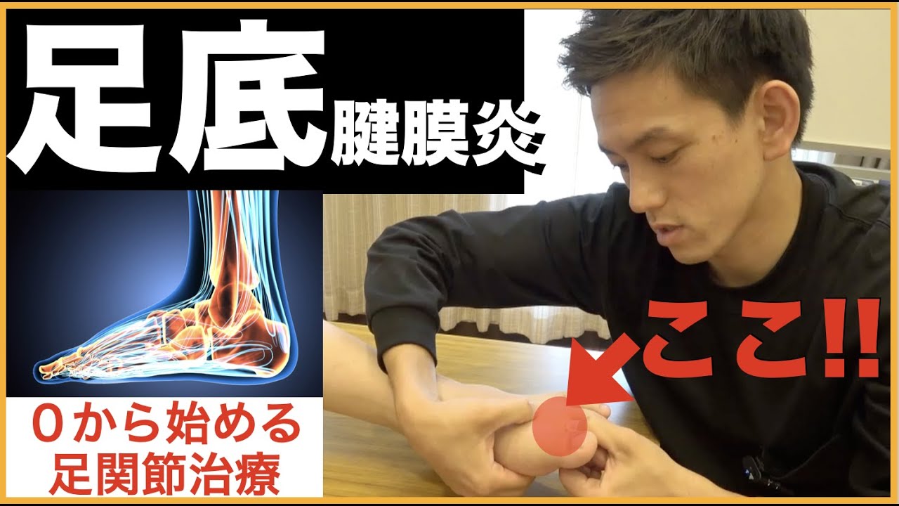 【世界No 1テクニック】30秒で3年足底腱膜炎を消すテクニック