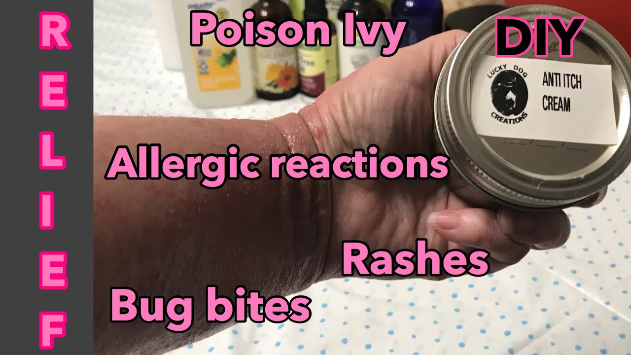 DIY Anti Itch Cream