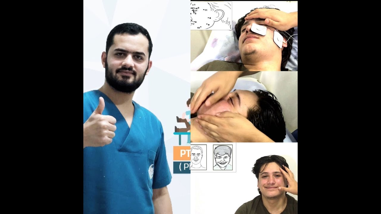 المعالجة الفيزيائية- لشلل بل (اللقوة المحيطة)___Bell's palsy -Physical therapy