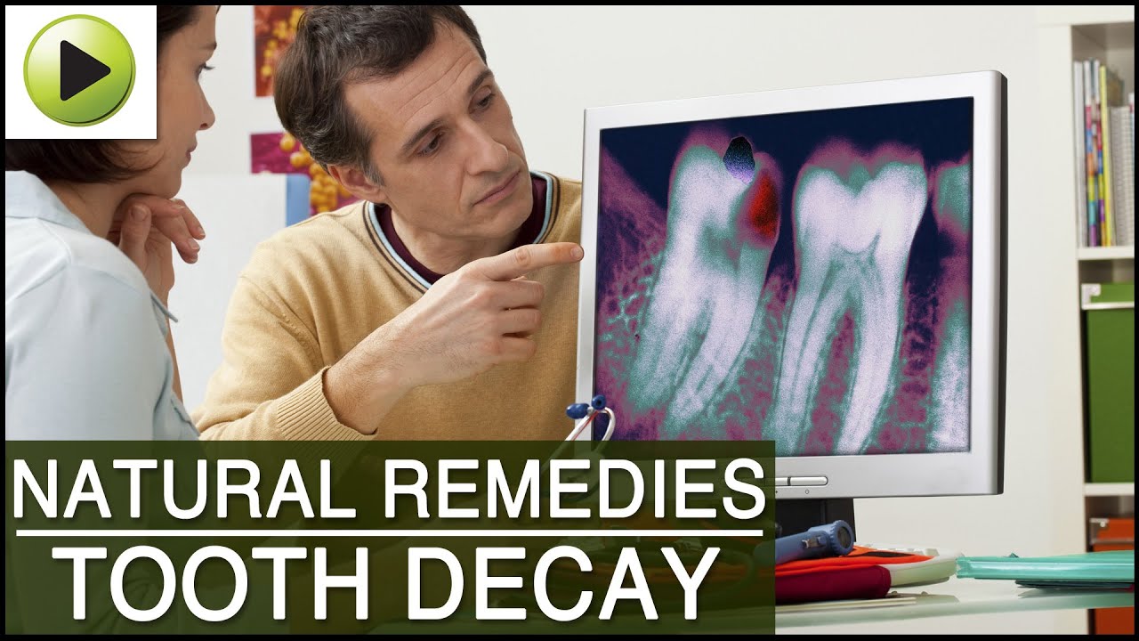 Tooth Decay - Natural Ayurvedic Home Remedies