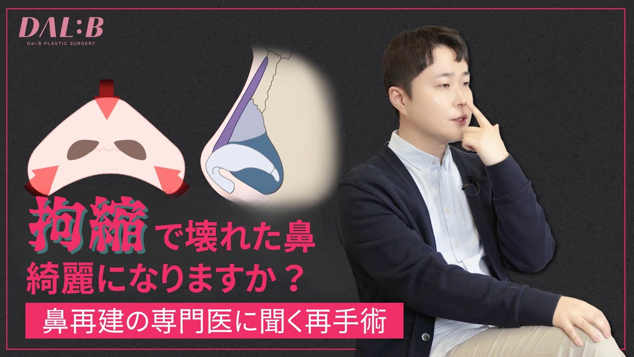 【鼻再手術】拘縮で変形した鼻、治せますか？再手術の限界と可能性を専門医が解説｜韓国・シンサ駅 ダルビ美容外科