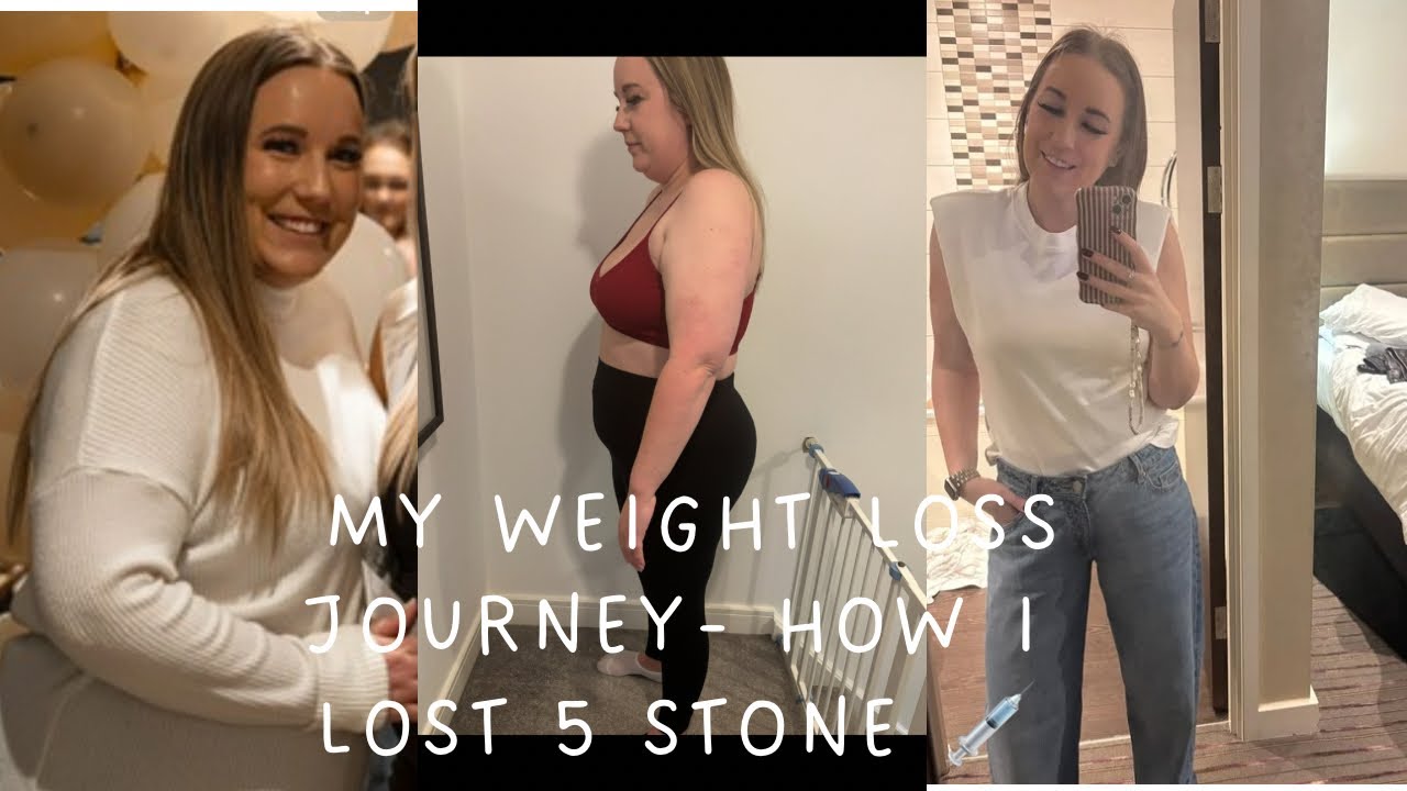 MY WEIGHT LOSS JOURNEY | HOW I LOST 5 STONE 💉| ELISHA HODGSON 