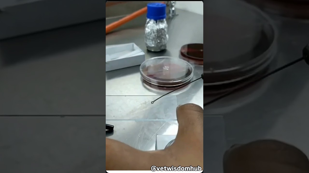 📌 KOH Test: The Simple & Effective Fungal Diagnosis Method! 🦠🔬