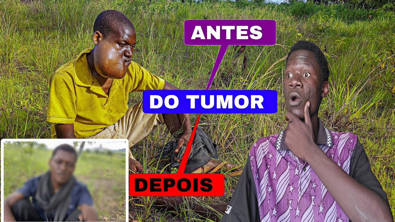 Atualização que todo mundo esperava sobre tumor de Elias | em Moçambique África 