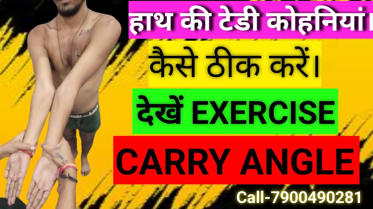 Carry Angle \ Cubitus Vulgus कैसे ठीक करें देखें Exercise। #carryangle #cubitusvulgus